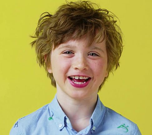 Invisalign® first