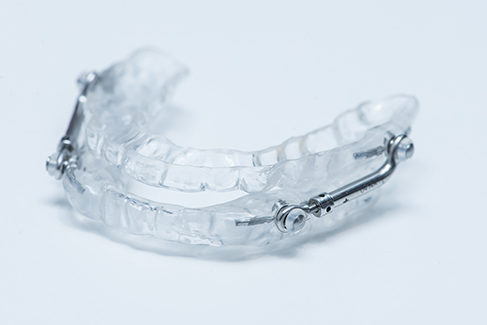 oak brook orthodontist sleep apnea orthognathic surgery surgical orthodontics hinsdale clarendon hills westmont willowbrook western springs