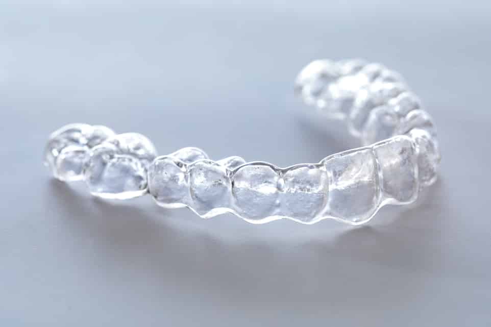 Retainers Vivera, Permanent, Removable, Spring Band & Wire